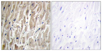 CYP2J2 rabbit pAb Antibody