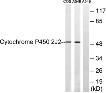CYP2J2 rabbit pAb Antibody