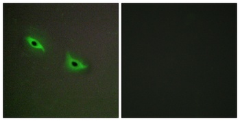 CYP2S1 rabbit pAb Antibody