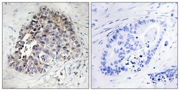 CYP2S1 rabbit pAb Antibody