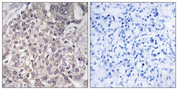 CYP4F2 rabbit pAb Antibody