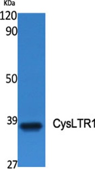 CysLTR1 rabbit pAb Antibody