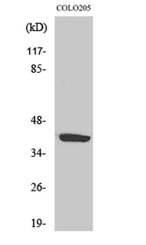 CysLTR1 rabbit pAb Antibody
