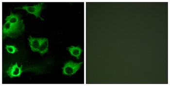 CysLTR1 rabbit pAb Antibody