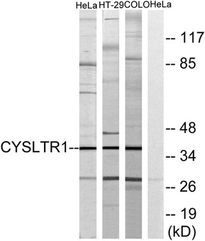 CysLTR1 rabbit pAb Antibody