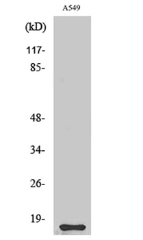 Cystatin 11 rabbit pAb Antibody