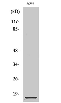 Cystatin B rabbit pAb Antibody