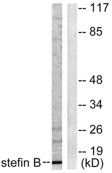 Cystatin B rabbit pAb Antibody