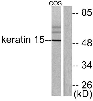 Cytokeratin 15 rabbit pAb Antibody