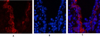Cytokeratin 19 rabbit pAb Antibody