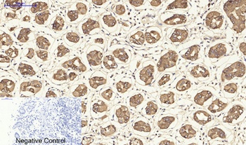 Cytokeratin 19 rabbit pAb Antibody