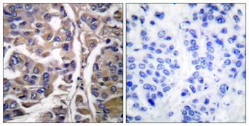 Cytokeratin 20 rabbit pAb Antibody