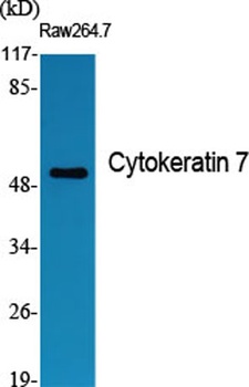 Cytokeratin 7 rabbit pAb Antibody