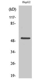 Cytokeratin 7 rabbit pAb Antibody