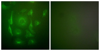Cytokeratin 7 rabbit pAb Antibody