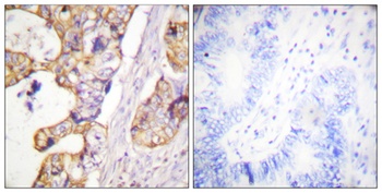 Cytokeratin 8 rabbit pAb Antibody