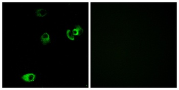 D4DR rabbit pAb Antibody