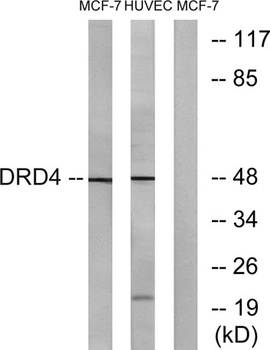 D4DR rabbit pAb Antibody