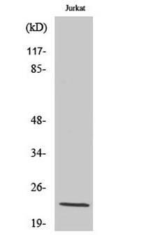 D54 rabbit pAb Antibody
