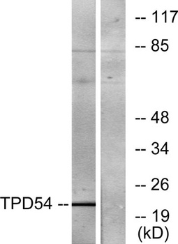 D54 rabbit pAb Antibody