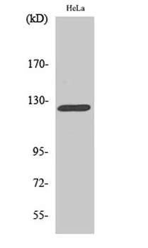 DDR1 rabbit pAb Antibody