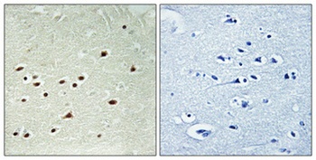 DDX51 rabbit pAb Antibody