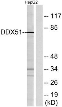 DDX51 rabbit pAb Antibody
