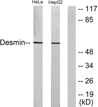 Desmin rabbit pAb Antibody