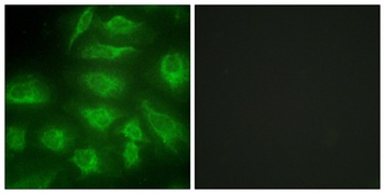 DGK-ι rabbit pAb Antibody