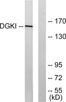 DGK-ι rabbit pAb Antibody