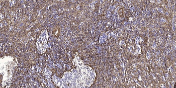DGK-ι rabbit pAb Antibody