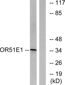 D-GPCR rabbit pAb Antibody