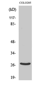 DHRS2 rabbit pAb Antibody