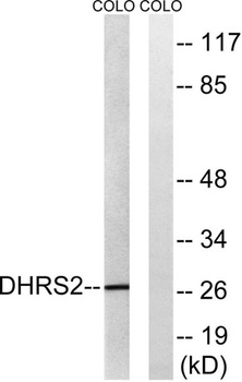 DHRS2 rabbit pAb Antibody