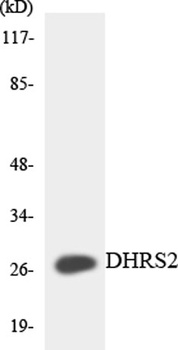 DHRS2 rabbit pAb Antibody