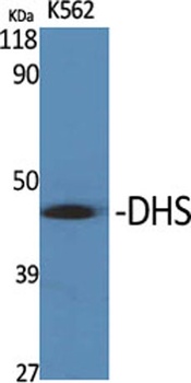 DHS rabbit pAb Antibody