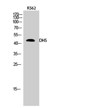 DHS rabbit pAb Antibody