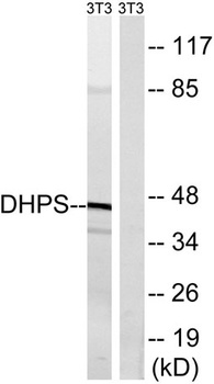 DHS rabbit pAb Antibody
