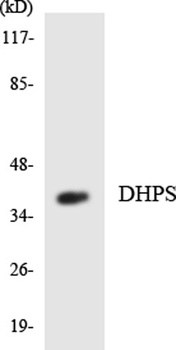 DHS rabbit pAb Antibody