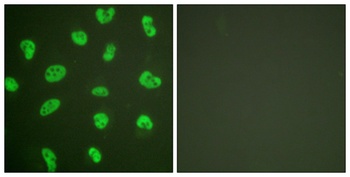 DNA-PKCS rabbit pAb Antibody