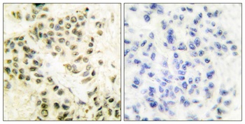 DNA-PKCS rabbit pAb Antibody