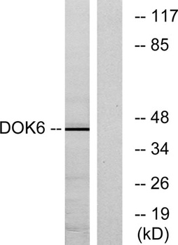 Dok-6 rabbit pAb Antibody