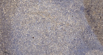 Dok-6 rabbit pAb Antibody
