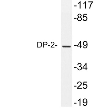 DP-2 rabbit pAb Antibody
