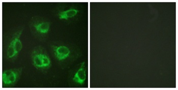 DREAM rabbit pAb Antibody