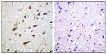 DREAM rabbit pAb Antibody