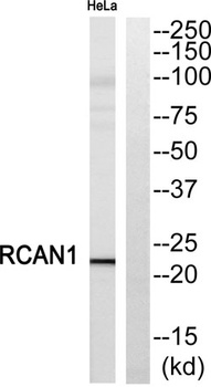 DSCR 1 rabbit pAb Antibody