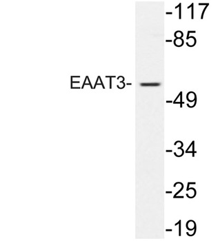 EAAT3 rabbit pAb Antibody