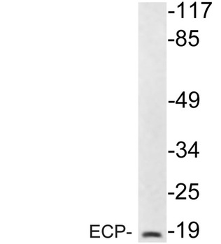 ECP rabbit pAb Antibody