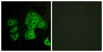 EDG-6 rabbit pAb Antibody